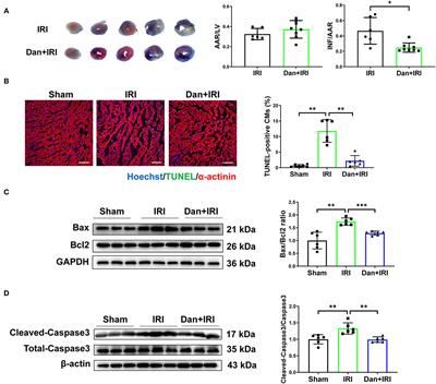 PPARγ Mediates the Cardioprotective Roles of Danlou Tablet After Acute Myocardial Ischemia-Reperfusion Injury